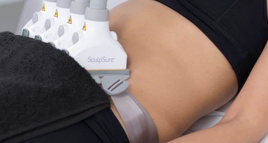 SculpSure